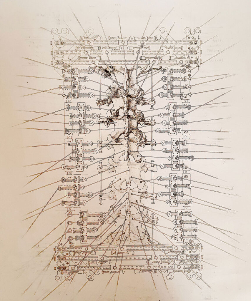 start of hatching on the drawing titled surgical reliquary number one
